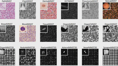 Probabilistic Graphical Models – Generative vs Discriminative Robustness in Medical Imaging featured image