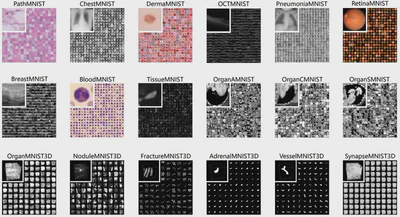 Probabilistic Graphical Models – Generative vs Discriminative Robustness in Medical Imaging featured image