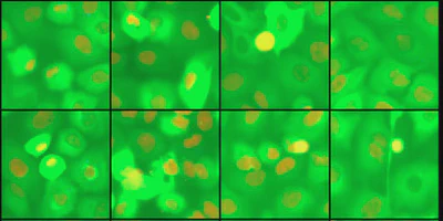 Multi Marginal Temporal Schrödinger Bridge for Video Generation from Static Unpaired Data featured image